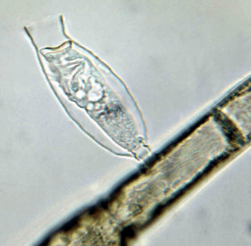 污水处理常见微生物照片